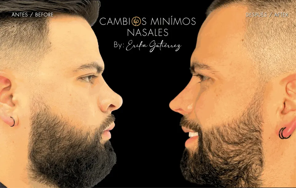 Antes y despues hombre