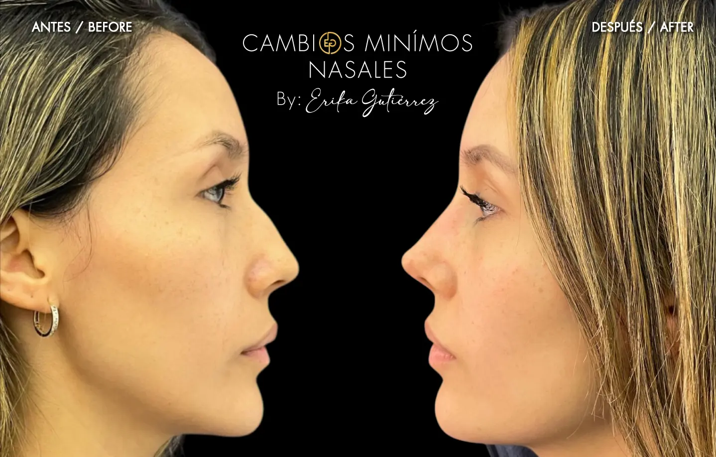 cambios mínimos faciales