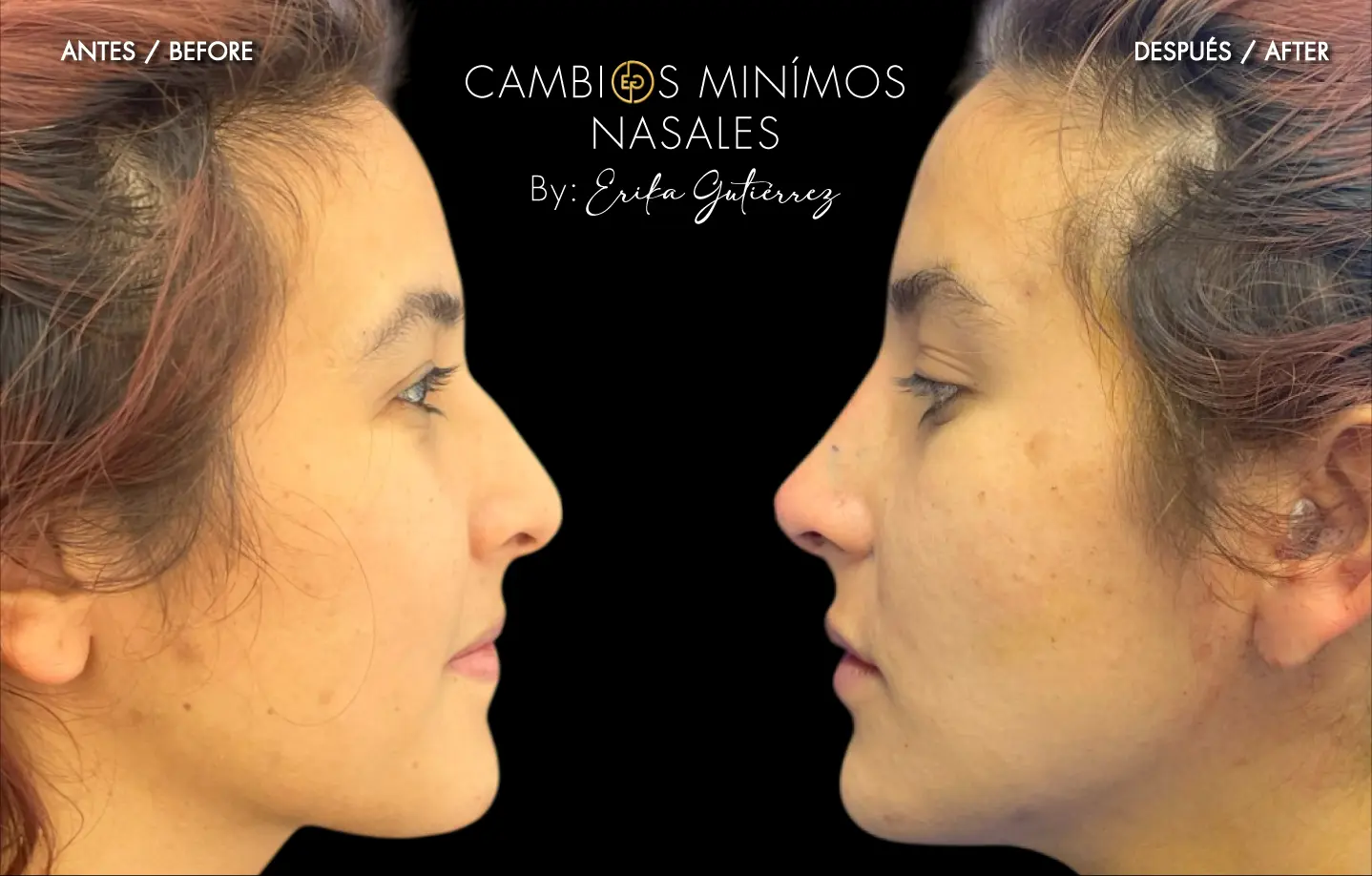 cambios mínimos faciales