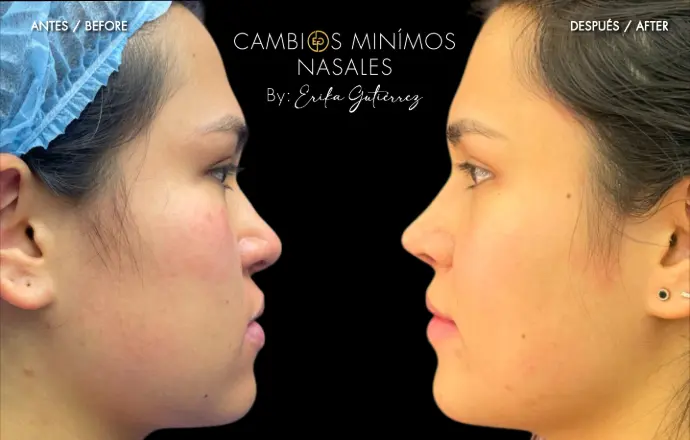 cambios mínimos faciales